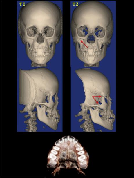 Fig 9