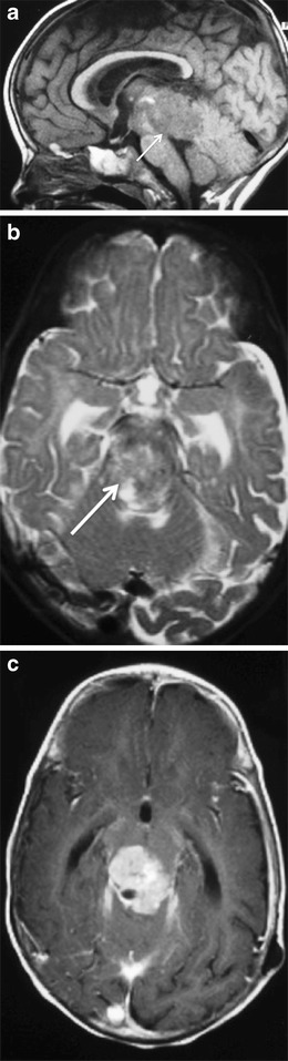 Fig. 15