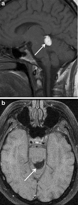 Fig. 11