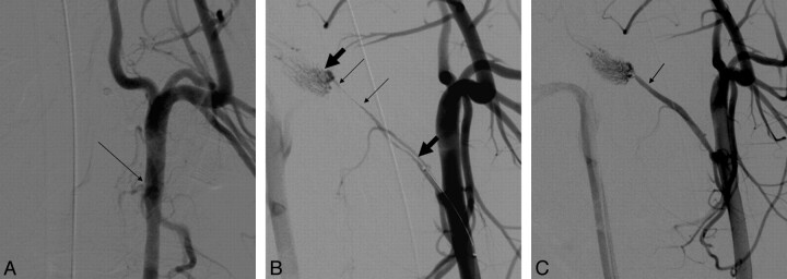 Fig 1.