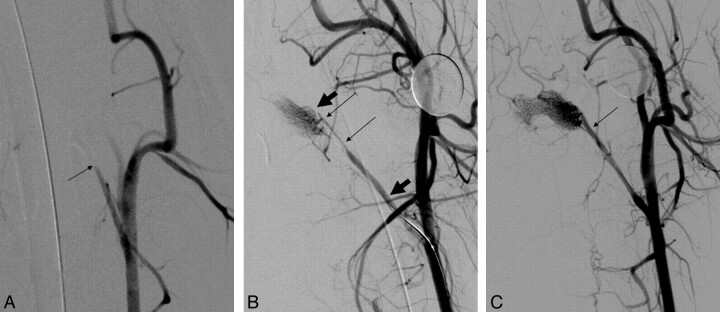 Fig 2.