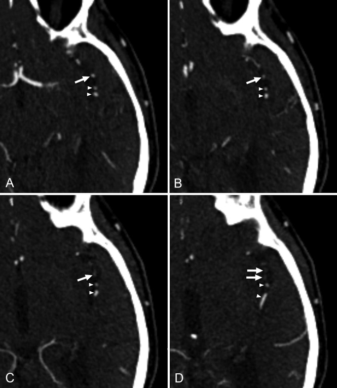 Fig 1.