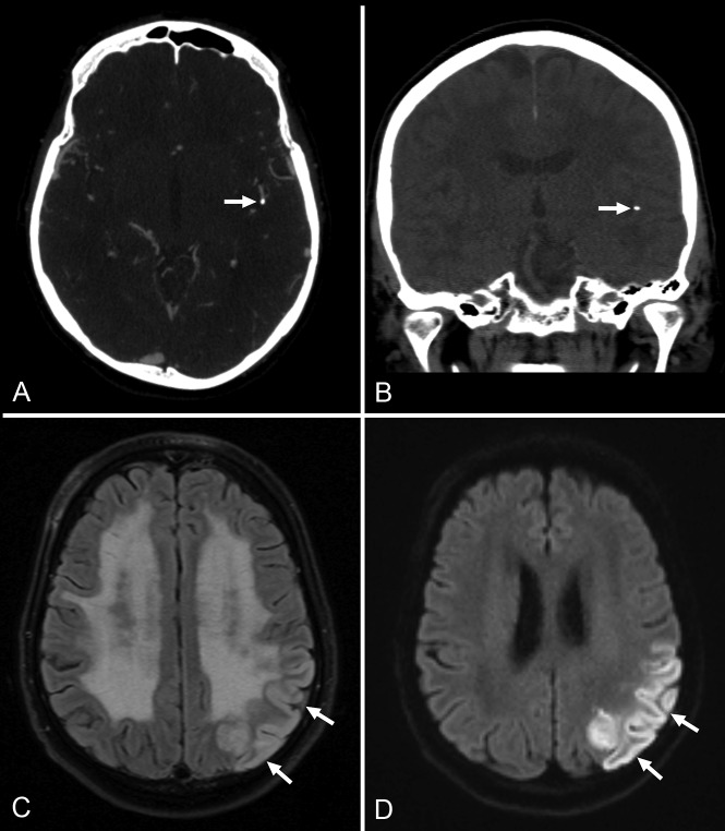 Fig 2.