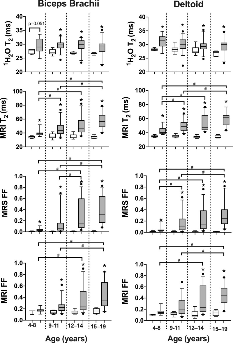 Box and whisker plots show proton (1H) MR spectroscopy (MRS) 1H2O T2 (msec), MRI T2 (msec), MR spectroscopy fat fraction (MRS FF), and chemical shift-encoded imaging fat fraction (MRI FF) of the biceps brachii and deltoid in control participants and participants with Duchenne muscular dystrophy (DMD) in different age groups. Statistical significance was defined as a P value less than the Bonferroni-corrected P value. No differences were observed among age groups in control participants. Whisker bars represent 5th and 95th percentiles and dots are shown for outliers. * Significantly different than controls. # Significantly different between age groups in participants with DMD.