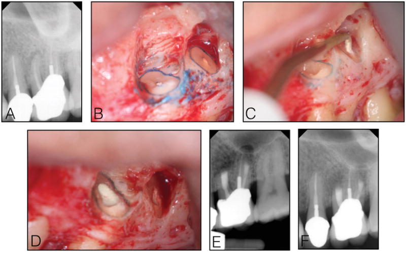 Fig 6