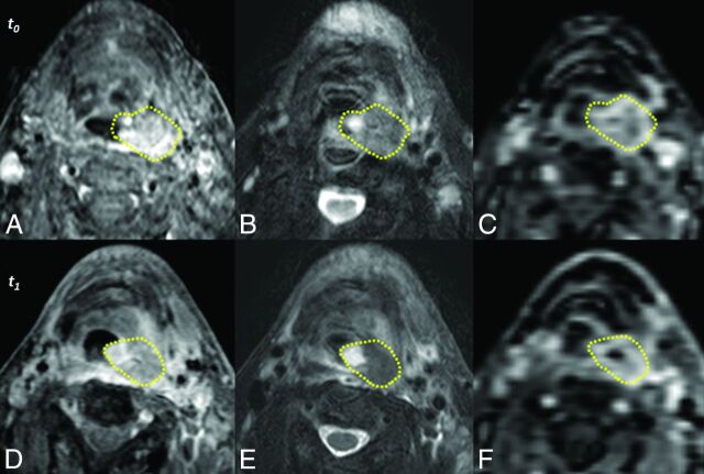 Fig 2.