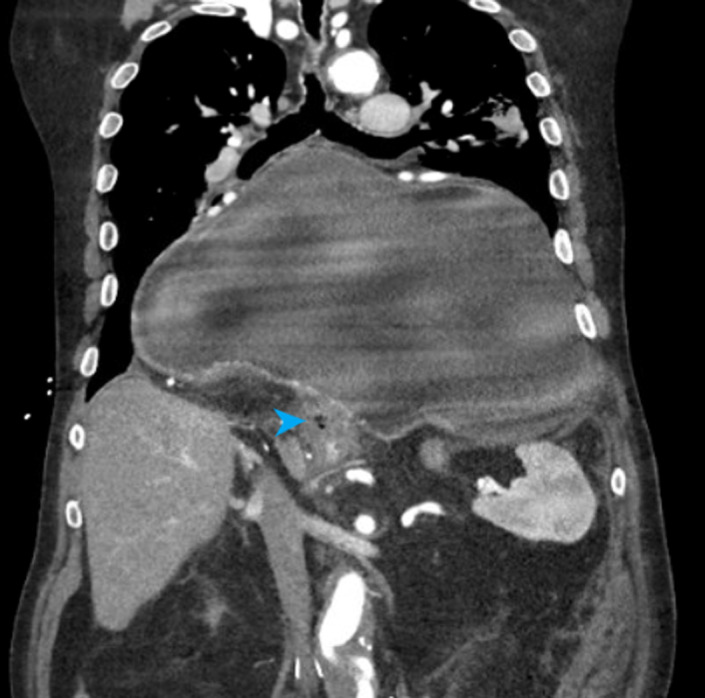 FIGURE 2