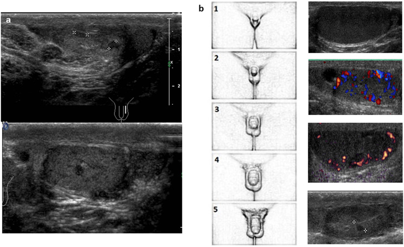 FIGURE 9