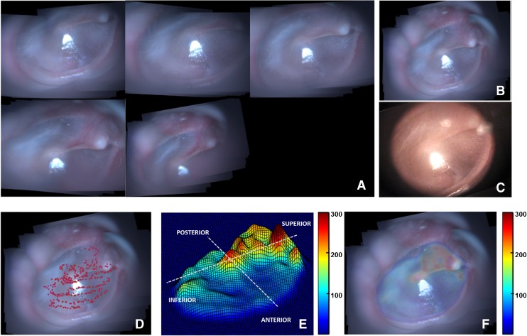 FIG. 4