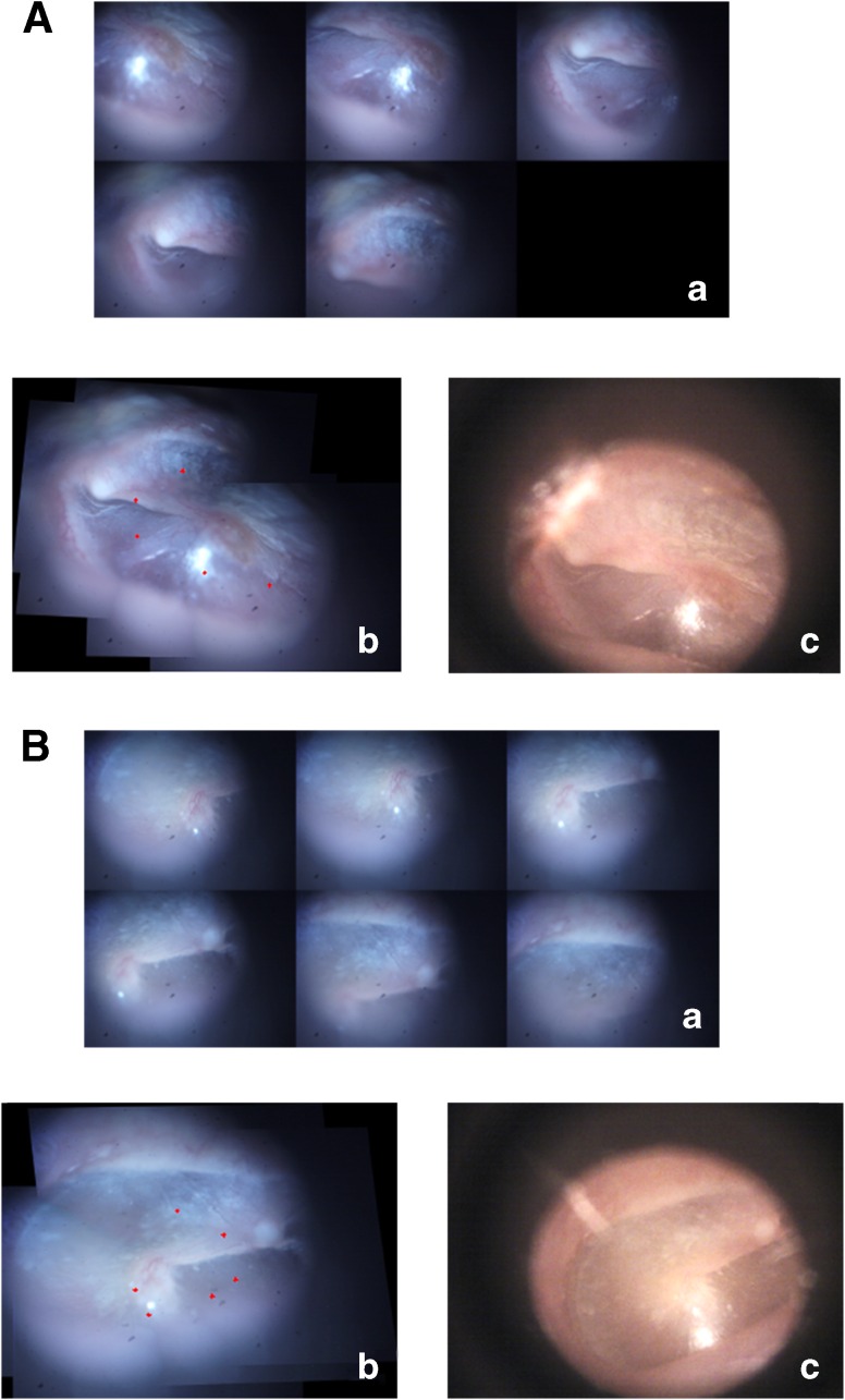 FIG. 3