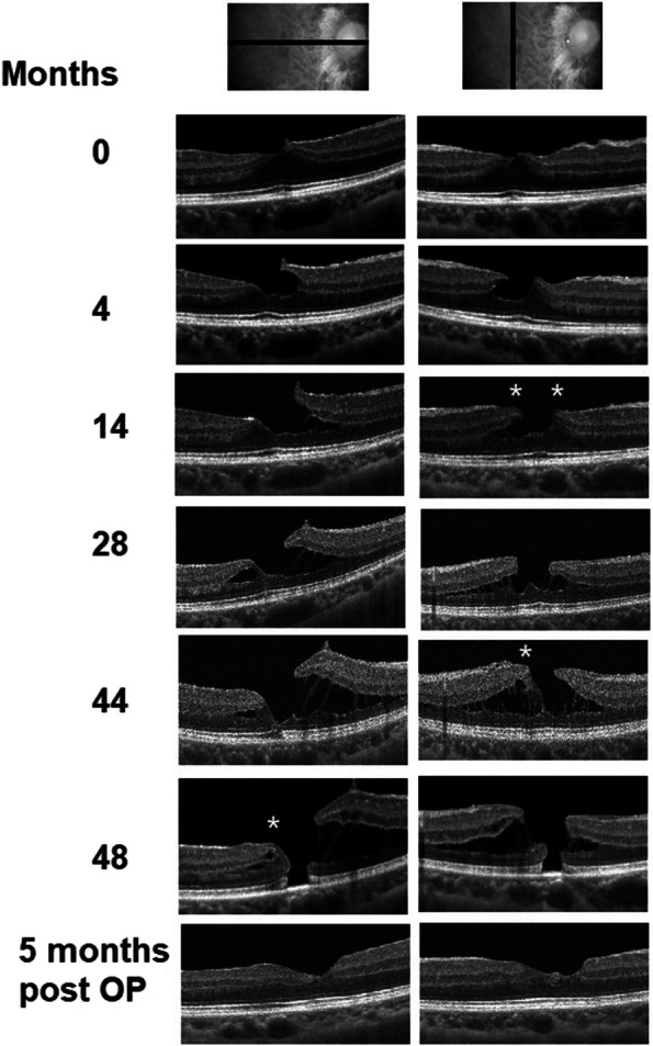 Fig. 3