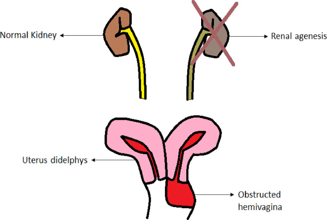 Fig 2