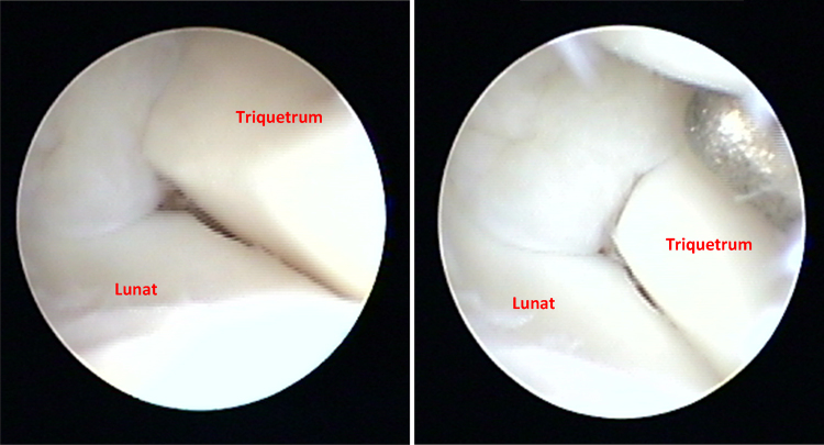 Fig. 5