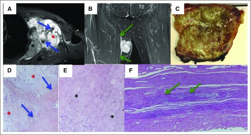 Fig 1.