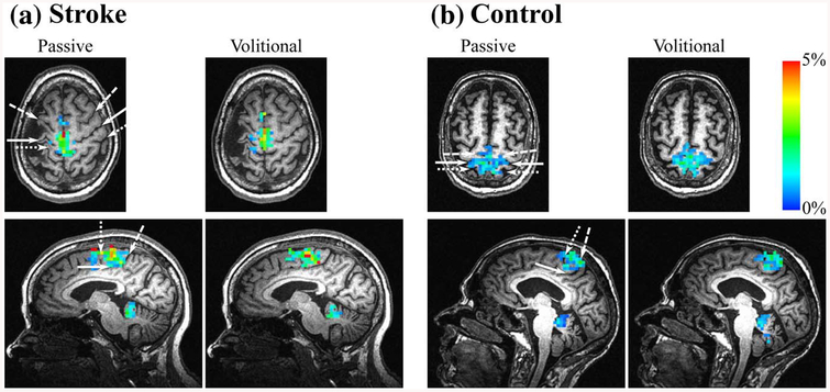 Figure 4 —