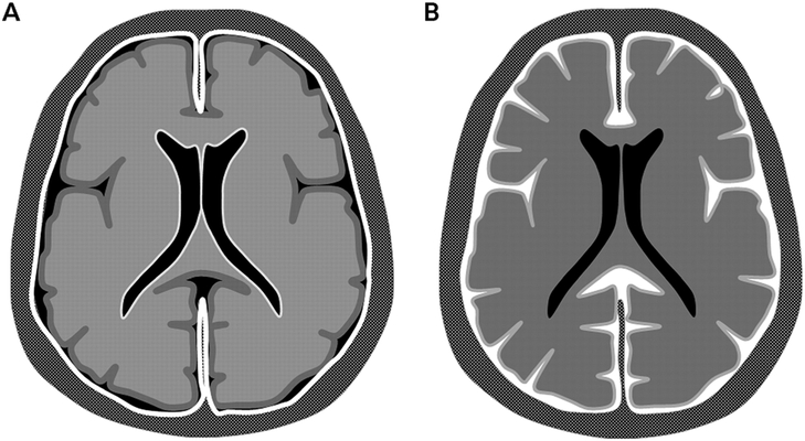 FIGURE 3-2