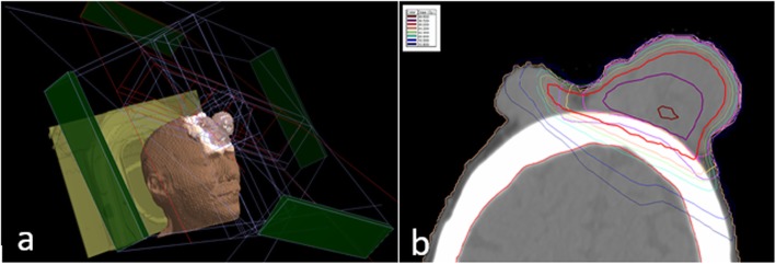 Fig. 4