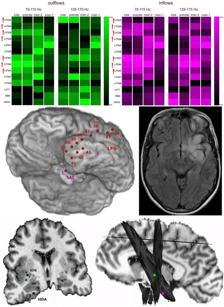 Fig. 13