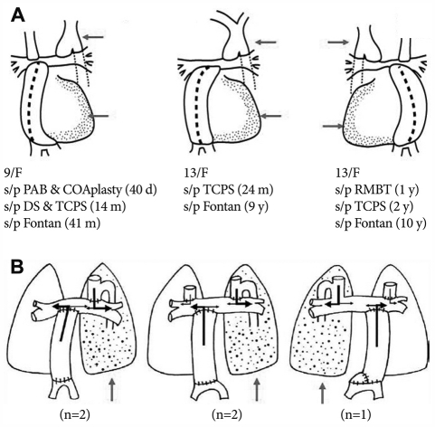 Heterotaxy Syndrome - PMC