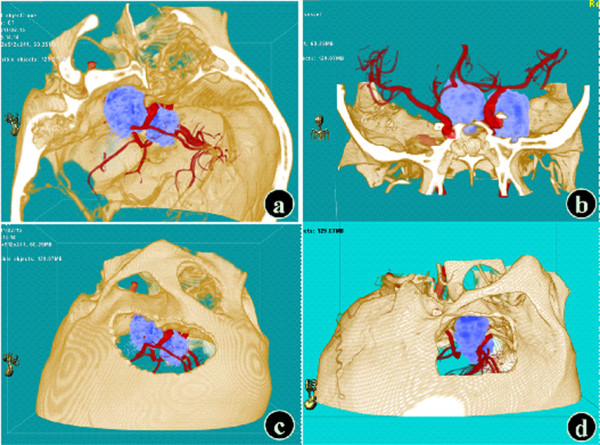 Figure 4