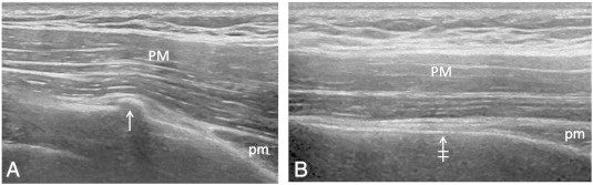 Fig 3