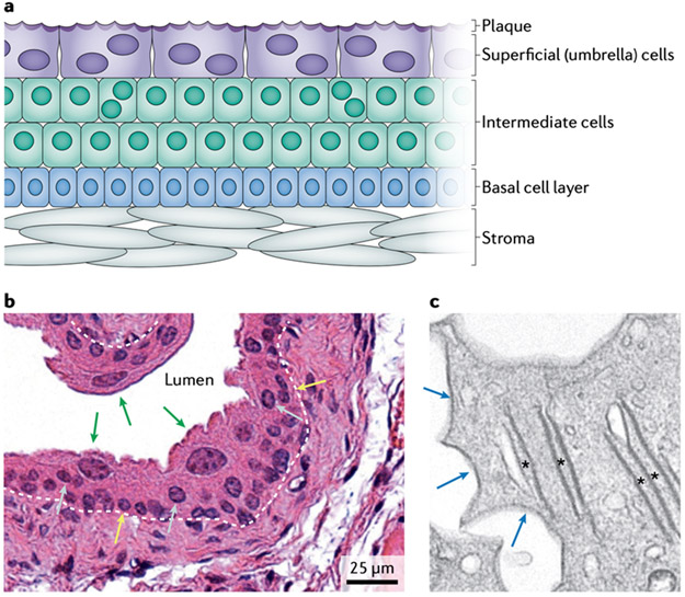 Roles for urothelium in normal and aberrant urinary tract development - PMC