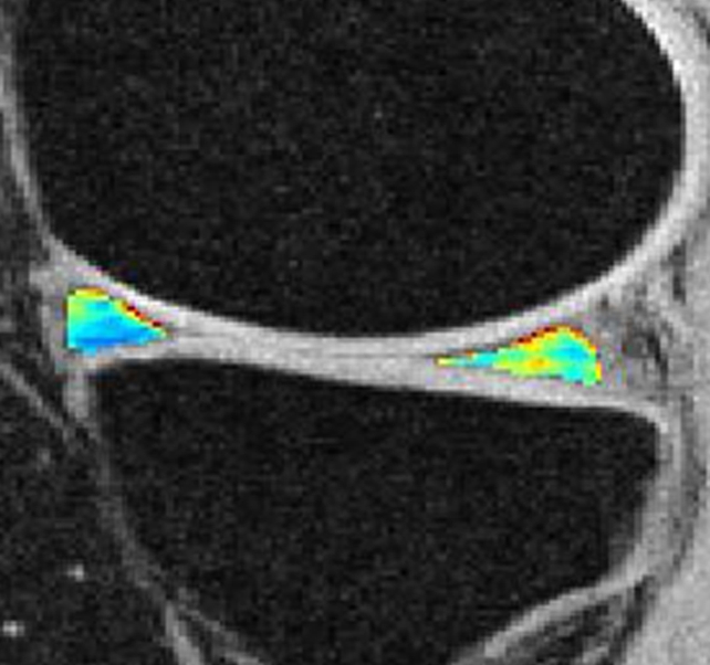 Figure 2d: