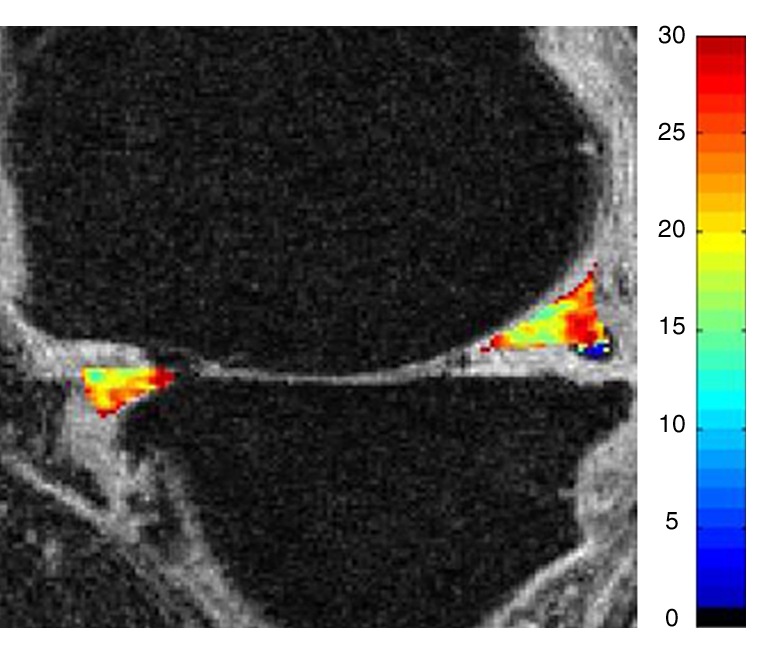 Figure 2f: