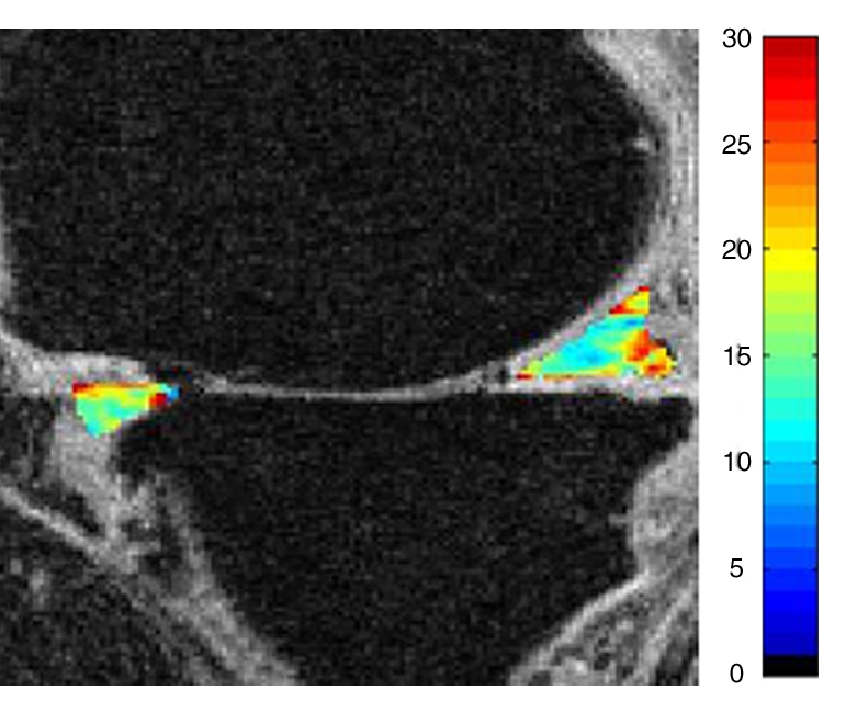 Figure 2i: