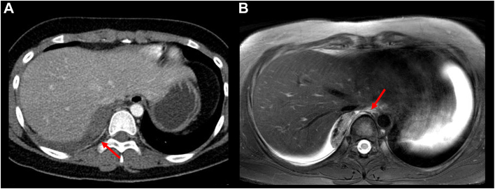 Figure 2