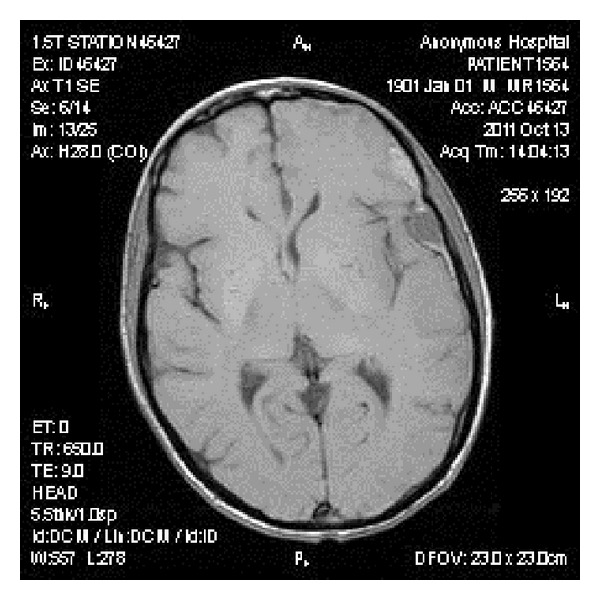 Figure 2