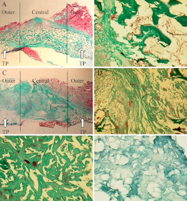 Fig. 3A–F