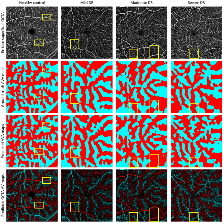 Figure 12.