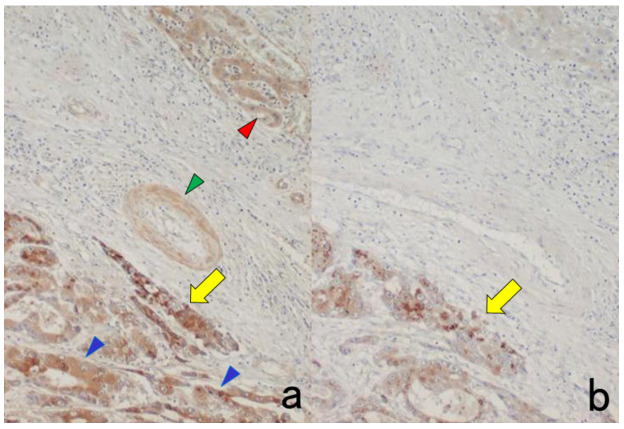 Figure 17