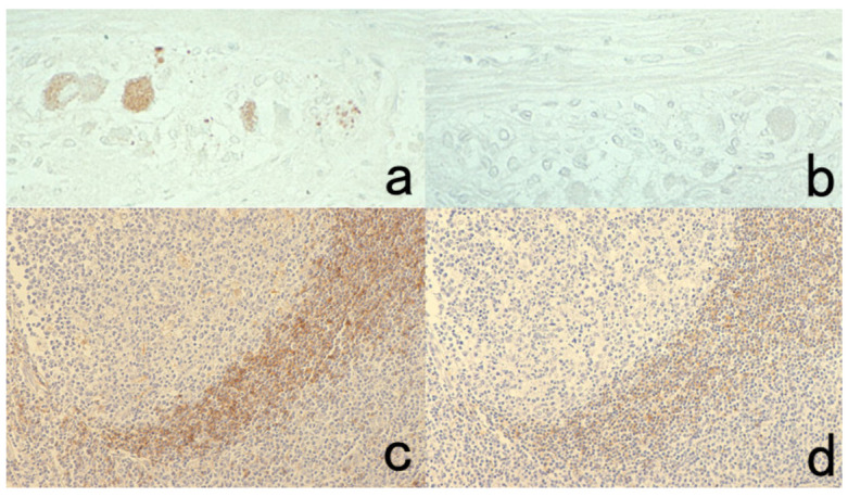 Figure 32