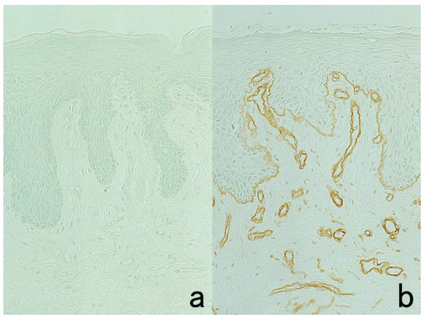 Figure 30