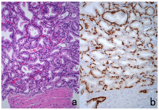 Figure 52