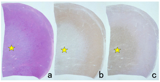 Figure 16