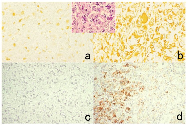 Figure 35