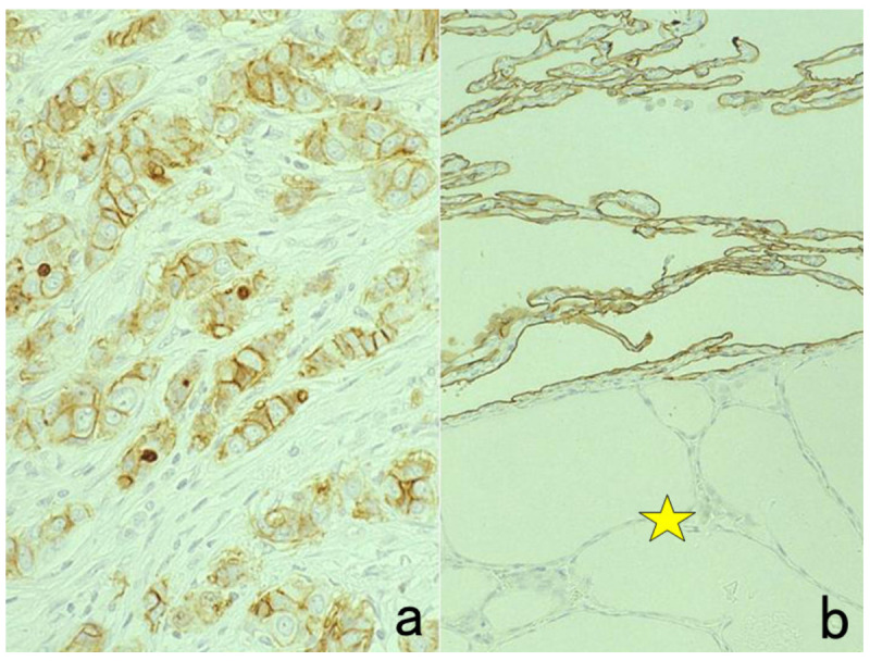 Figure 46