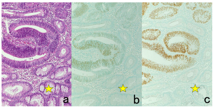 Figure 34