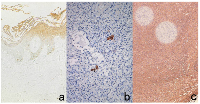 Figure 23