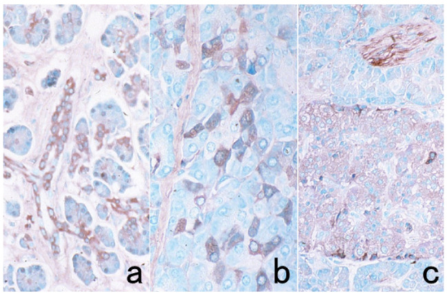 Figure 13