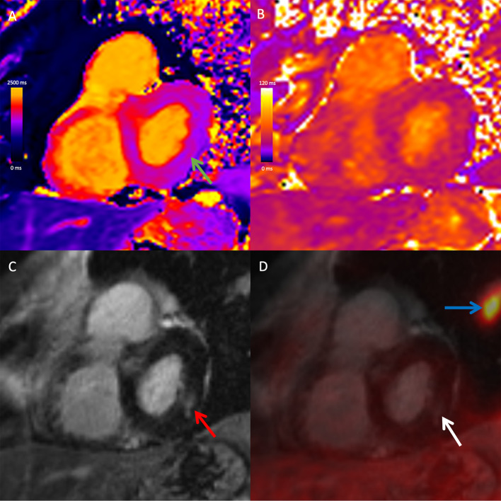 Fig. 2