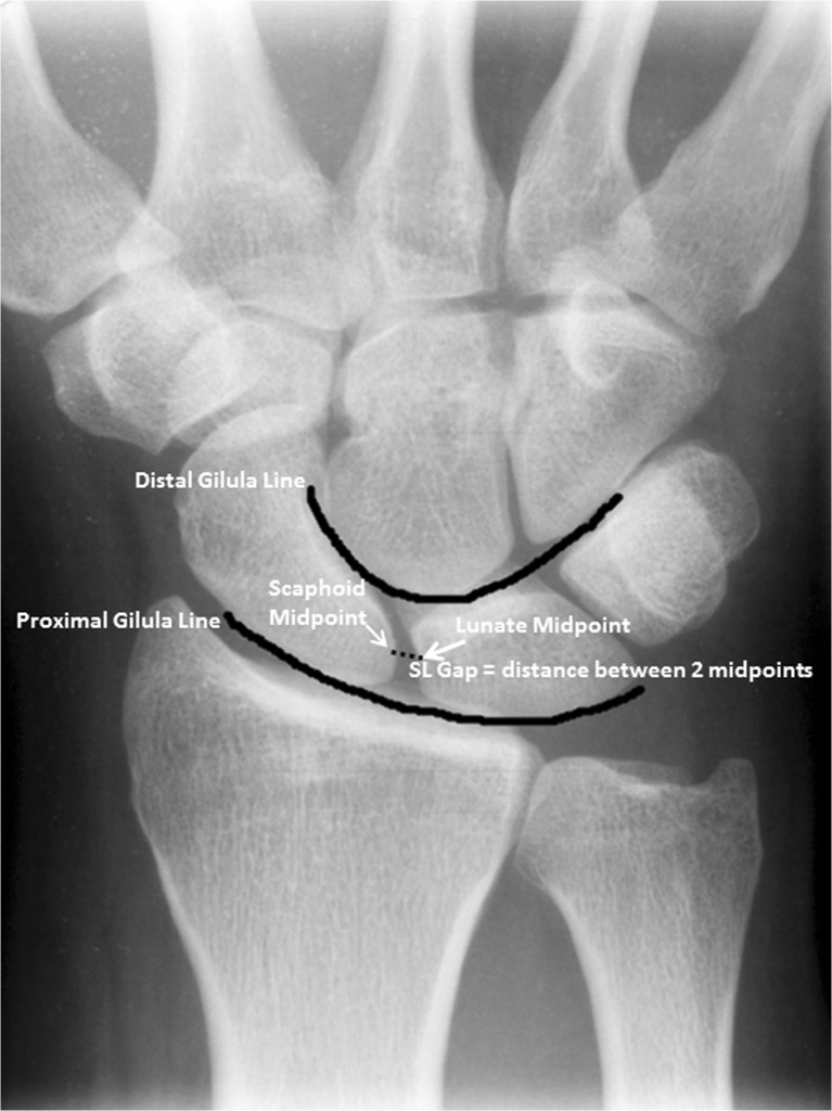 Fig. 2