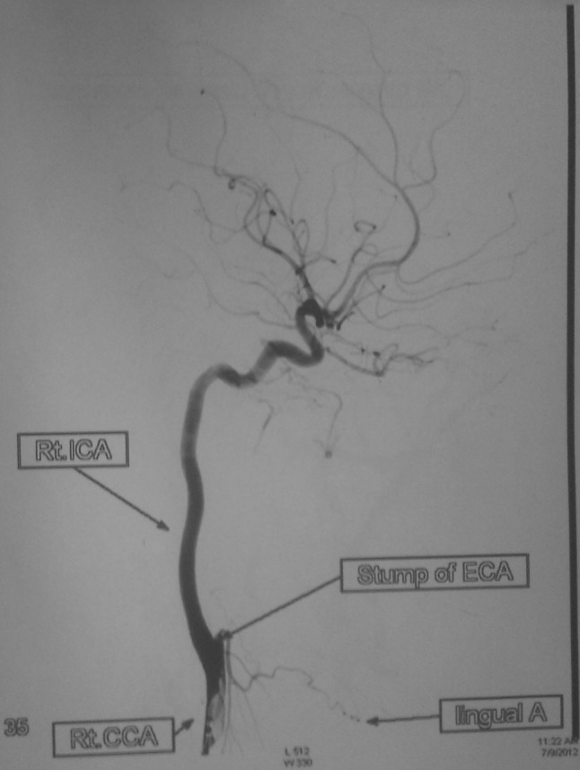 Fig. 15