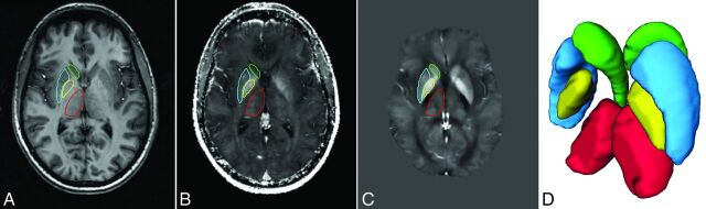 Fig 1.