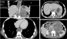 Fig. 4