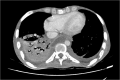 Fig. 14