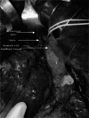 Fig. 12